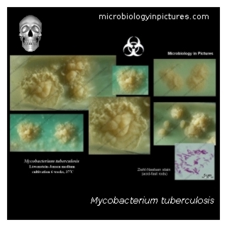 mycobacterium tuberculosis